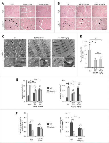 Figure 2 (see previous page). Spermidine treatment ameliorates the myopathic phenotype of col6a1−/− mice. (A, B) Haematoxylin-eosin staining of cross sections of tibialis anterior muscles from untreated (Ctrl) and per os (A) or i.p. (B) spermidine-treated wild-type and col6a1−/− mice. In col6a1−/− mice, centrally nucleated fibers (black arrowheads) and atrophic fibers (white arrowheads) appear reduced after spermidine treatment. Scale bar: 50 μm. (C) Representative electron micrographs of diaphragm thin sections from untreated (a to c) and per os (d to f) or i.p. (g to i) spermidine-treated col6a1−/− mice. Low-power views (upper panels) reveal improvement of muscle ultrastructure following spermidine treatment. High-power magnifications (lower panels) show dilated sarcoplasmic reticulum (SR) and swollen mitochondria (mit) in untreated col6a1−/− mice (b,c), and the presence of autophagic vacuoles (AV) in spermidine-treated col6a1−/− mice (f,i) together with a marked amelioration of organelle morphology (e,h). Scale bar: 1 μm (upper panels) or 500 nm (lower panels). (D) Percentage of morphologically altered mitochondria in the diaphragm of untreated (Ctrl) and spermidine-treated (PO 30, per os 30 mM; IP 50, i.p. 50 mg/kg) col6a1−/− mice (n = 3 or 4; P< 0.05; NS, not significant.) (E) Quantification of apoptosis by TUNEL assay in diaphragm muscles of untreated (Ctrl) and per os (left panel) or i.p. (right panel) spermidine-treated wild-type and col6a1−/− mice (n = 3, each group; **, P < 0.01; ***, P < 0.001). (F) In vivo tetanic force measurements in gastrocnemius muscle of untreated (Ctrl) and per os or i.p. spermidine-treated wild-type and col6a1−/− mice. The histograms report the normalized strength at a stimulation frequency of 100 Hz (n = 5, each group; ***, P<0.001; NS, not significant). Ctrl, untreated control condition; Spd IP, spermidine i.p.; Spd PO, spermidine per os. WT, wild-type.
