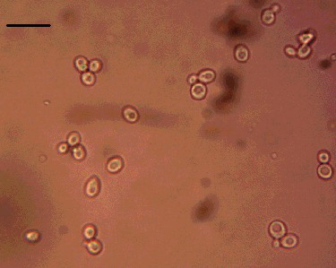Figure 2. Microscopic observation of yeast zygote.