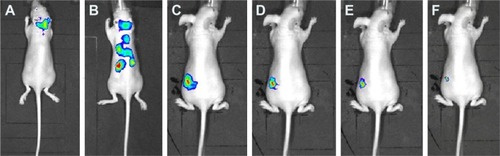 Figure 9 In vivo biodistribution of PLGA-PEG/PFOB emulsion after pulmonary delivery at times of (A) 1, (B) 2, (C) 3, (D) 4, (E) 5, and (F) 6 h.Abbreviations: PLGA-PEG, poly(lactide-co-glycolide)-poly(ethylene glycol); PFOB, perfluorooctyl bromide.