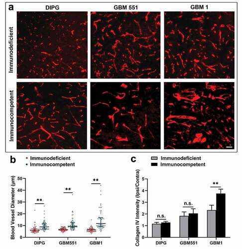 Figure 6. The vascular differences in immunodeficient and immunocompetent hosts of DIPG, GBM1, and GBM551 tumors. (a) Collagen IV staining showed the different blood vessel morphologies in DIPG, GBM1, and GBM551 mice. The scale bar is 50 μm. (b) Quantification analysis of blood vessel diameter showed enhanced vascularization of tumors in immunocompetent mice. N = 180 blood vessels from three animals/group (60 blood vessels for each animal). Median with IQR, ** p< 0.01, Mann–Whitney U test. (c) Quantification analysis of Collagen IV intensity showed more blood supply of GBM1 tumor in immunocompetent mice. N = 9 slices from three animals/group (three brain slices for each animal). Mean ± SD, **p < 0.01, n.s. is no significant difference, independent t-test.