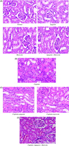 Figure 6. (A) Photomicrographs stained with hematoxylin and eosin from mice kidney sections of normal control, apigenin, myricetin and their combination. These sections showed normal renal histological picture. (B) Photomicrographs stained with hematoxylin and eosin from mice kidney sections of Cisplatin-treated group showing extensive tubular necrosis, tubular dilatation, vacuolization and cast formation. (C) Photomicrographs stained with hematoxylin and eosin from mice kidney sections of Cisplatin-treated groups with apigenin and myricetin displaying remarkable improvement in the histological appearance. (D) Photomicrographs stained with hematoxylin and eosin from mice kidney sections of Cisplatin-treated groups with apigenin and myricetin combination showing nearly normal histological appearance.
