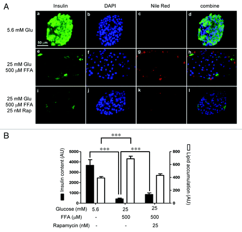 Figure 5.(A) Rat islets (50) were cultured for 4 days in cCMRL containing 5.6 mM glucose, 25 mM glucose + 500 μM FFAs, or 25 mM glucose + 500 μM FFAs + 25 nM rapamycin. Frozen sections (5 μm) of islets were processed for immunostaining [insulin (green), nuclei (blue), and Nile red (red)] as described in the Methods section. Images were rescaled using Adobe Photoshop software. (B) The bar graph shows the average intensities of Nile red for lipid accumulation and DyLight 647 for insulin, respectively, of 15–20 islet sections per condition from three different experiments.