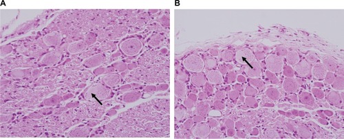 Figure 3 Microscopic findings for the left dorsal root ganglia 1 week after epidural injection.