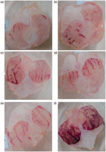 Figure 1. (a) Stomach of rat treated with okra 500; (b) Stomach of rat treated with okra 250; (c) Stomach of rat treated with okra 100; (d) Stomach of rat treated with Fam 20; (e) Stomach of rat treated with Que 75; and (f) Stomach of rat treated with ethanol (80%).
