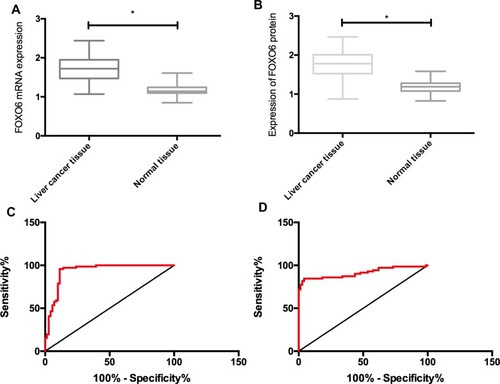 Figure 1 Expression and clinical significance of FOXO6 in HCC. (A) Expression of FOXO6 mRNA in HCC. (B) Expression of FOXO6 protein in HCC. (C) Diagnostic value of FOXO6 mRNA in HCC. (D) Diagnostic value of FOXO6 protein in HCC. *Indicates P<0.05.