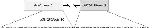 Figure 5. RUNX1 gene fusion as a result of the deletion seen in pedigree A. Targeted RNA sequencing of individual V:1 from pedigree A resulted in the detection of an expressed gene fusion of RUNX1 exon 7 and exon 2 of a non-coding RNA, LINC00160, on the same strand as RUNX1. The gene fusion results in a frameshift and a stop codon, p.Thr270Argfs26.