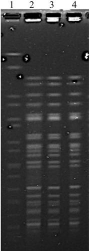 Figure 1 PFGE of K. pneumoniae K60, K65 and K77. Lanes 1, marker Salmonella braenderup H9812; line 2 to 4, PFGE image of K. pneumoniae K60, K65 and K77.
