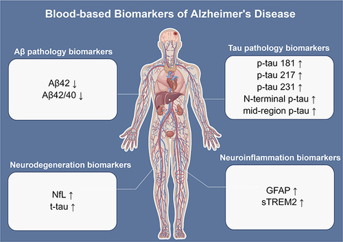 Figure 1 Overview of the most promising blood-based biomarkers of AD. The biomarkers can be divided into four aspects: Aβ pathology (Aβ42 and Aβ42/40 ratio), tau pathology (p-tau181, p-tau217, p-tau231, N-terminal p-tau, and mid-region p-tau), neurodegeneration (NfL and t-tau), and neuroinflammation (GFAP and sTREM2). The figure was made by Figdraw (ID: RAWSR4a31d).