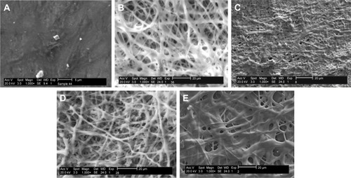 Figure 6 SEM images of degradability of the non-cross-liked and cross-linked electrospun mats. Non-cross-linked CO (A), cross-linked CO mats after 24 h (B) 200 mM EDC, and (C) 600 mM EDC, cross-linked CO–CS mats after 24 h (D) 200 mM EDC and (E) 600 mM EDC (1,000×).Abbreviations: SEM, scanning electron microscopy; CO, collagen; CS, chondroitin sulfate; EDC, 1-ethyl-3-(3-dimethyl-aminopropyl)-1-carbodiimide hydrochloride.