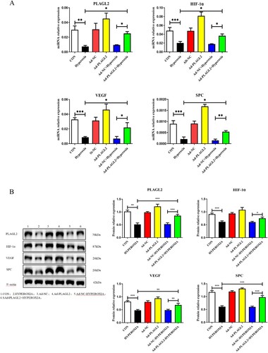 Figure 4. Upregulation of PLAGL2 activates the HIF-1α/VEGF signaling pathway in AECII cells. (A) Upregulation of PLAGL2 increased the mRNA expression of genes related to the HIF-1α/VEGF signaling pathway. (B) Western blot analysis revealed that upregulation of PLAGL2 enhanced the protein expression of the HIF-1α/VEGF signaling pathway. Statistical significance was determined as *p < 0.05, **p < 0.01, ***p < 0.001.