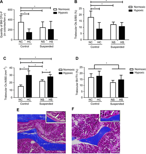 Figure 3 Hypoxia modulates bone cell responses to suspension, without altering the suspension-driven bone loss. (A) Clonogenic capacity was assessed by colony-forming unit-fibroblast (CFU-F) assay in bone marrow (BM) of normoxic control (NC), normoxic suspended (NS), hypoxic control (HC) and hypoxic suspended (HS) animals (n=10/group). (B) Histomorphometric quantification of osteoblast surface normalized to bone surface (Ob.S/BS). (C) Histomorphometric quantification of osteoclast number normalized to bone surface (Oc.N/BS). (D) Quantification of femur bone volume/total volume ratio (BV/TV). (E) Representative Masson’s trichrome stained trabeculae of normoxic control femur (NC group) showing bone lining osteoblasts compared to (F) representative trabeculae of hypoxic control femur (HC group) showing osteoclast. Scale bars represent 50 µm in the main picture area and 25 µm in the zoomed areas. Arrows point out osteoblasts (E) and osteoclast (F). All histomorphometric measurements were performed in the distal femoral metaphysis of the animals (For each experimental group n=5 littermate mice). *p≤0.05.