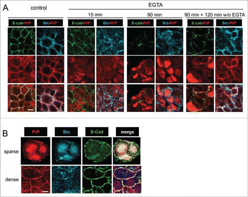 FIGURE 2. Calcium-dependent dissassembly of cell-cell junctions is sufficient to address PrPc to the nucleus and to delocalize Src from cell-cell contacts. (A) Confluent Caco-2/TC7 cells were treated with 2 mM EGTA for 15 or 90 minutes. For the reversion study, cells were washed after EGTA treatment and incubated for further 120 minutes in control medium. Immunostaining was performed for PrPc, Src and E-cadherin as indicated. As soon as 15 min after the beginning of EGTA treatment, E-cadherin and Src start to be delocalized from cell-cell junctions and to be more diffusely distributed in the cytoplasm, whereas part of PrPc is already detected in the nucleus, this localization being clearly observed at 90 minutes. After 2 hours of reversion, PrPc and Src are re-addressed to cell-cell junctions along with E-cadherin. (B) Src kinase is addressed to the nucleus with PrPc in low density proliferating intestinal cells. Exponentially growing Caco-2/TC7 cells were immunostained for PrPc, Src and E-cadherin as indicated. In small clusters (sparse cells, upper pannel), PrPc and Src accumulate in the nucleus, whereas in large clusters (dense cells, lower pannel), they are addressed at cell-cell contacts where they co-localize with E-cadherin. Bars : 10 µm (note that confluent cells in A are smaller than exponentially growing cells in B, as expected).