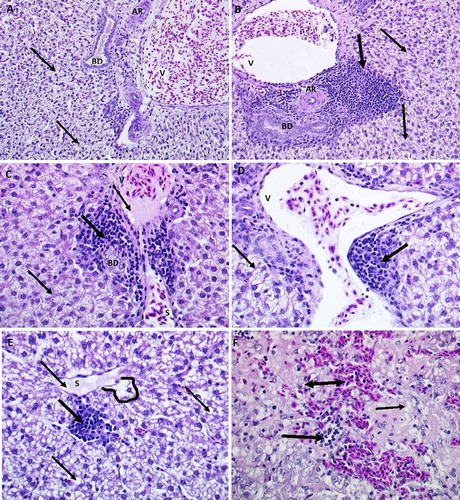 Figure 2. Histological sections (H&E stain) showing livers from control, LPS-treated, and E2- & LPS-treated hens. Image A (×200) shows normal portal triad from control hens (V = portal venule; AR = hepatic artery; BD = bile duct), with some hepatocyte fat infiltration (thin arrows). Image B (×200) shows inflammatory cell infiltration (thick arrow) in the periportal area surrounding portal triad. Images C and D (×400) show periportal inflammation in livers from E2-treated hens. Note moderate periportal inflammation (thick arrow) and fat infiltration (thin arrow). Images E and F (×400) show inflammation and haemorrhages in livers from LPS- & E2-treated hens. Note severe parenchymal and sinusoidal (S) fat (thin arrow), leukocyte (thick arrow), RBC (double-headed arrow) infiltration and sinusoidal dilation (lined area), congestion and telangiectasia.