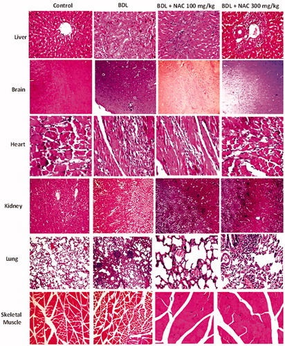 Figure 10. Effect of N-acetylcysteine (NAC) treatment on tissue histopathological changes in bile duct ligated (BDL) animal model of cirrhosis. Significant histopathological alterations were evident in different tissues of BDL animals (Supplementary file, Table 1). It was found that NAC supplementation (100 and 300 mg/kg) provided an ameliorative effect on BDL-associated tissue histopathological changes (Supplementary file, Table 1).