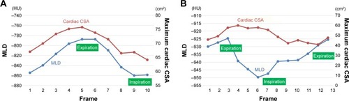 Figure 3 Measurements of MLD and maximum cardiac CSA.