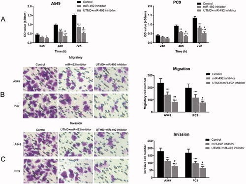 Figure 4. Effects of UTMD-mediated miR-492 inhibitor transfection on NSCLC cell proliferation, migration and invasion. (A) UTMD-mediated miR-492 inhibitor further inhibited cell proliferation compared with transfection of miR-492 inhibitor alone. (B, C) UTMD-mediated miR-492 inhibitor further inhibited cell migration and invasion compared with a single miR-492 inhibitor (*p < .05; **p < .01; ***p < .001; #p < .05; *compare with control, #compare with miR-492 inhibitor).