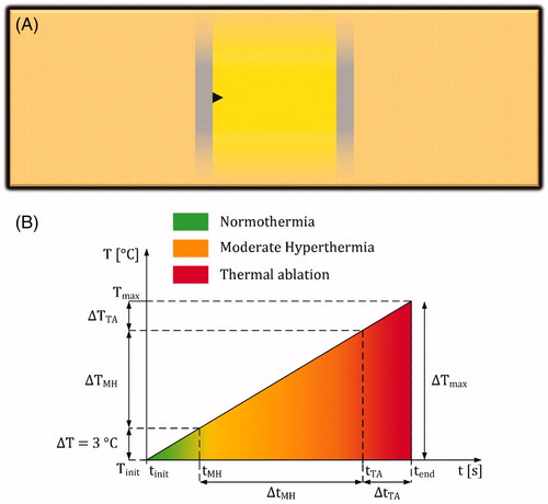 Figure 5. (A) Assumed model that includes infinite electrode plates to calculate the temperature increase during IRE. The electrodes are presented as gray rectangles with infinite length and IRE-TR as a yellow rectangle. The black triangle represents a possible location in the model with maximum temperature increase. (B) An example of a temperature increase profile based on EquationEquation 7(7) ΔT=J·E·tP·fPρcpΔt(7) , which is divided in normothermia (from tinit to tMH), moderate hyperthermia (MH; from tMH to tTA), and thermal ablation (TA; from tTA to tend).