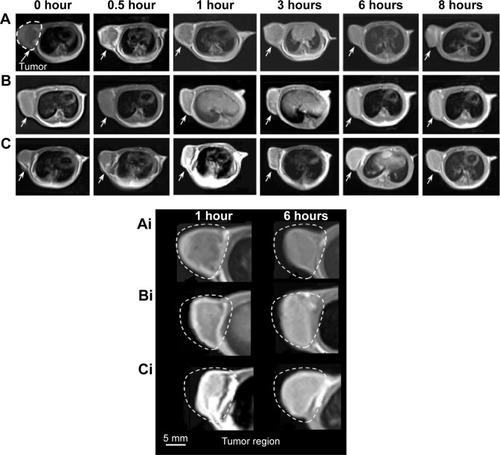 Figure 9 In vivo T1-weighted MRI images of (A) Gd-DTPA, (B) Gd/SWCNTs-COOH, and (C) Gd/SWCNTs-HA-ss-DOX.Notes: Arrows show the location of the tumor. Ai, Bi, Ci refer to the magnification of A, B, C at 1 hour and 6 hours.Abbreviations: DOX, doxorubicin; Gd, gadolinium; HA, hyaluronic acid; MRI, magnetic resonance imaging; SWCNTs, single-walled carbon nanotubes.