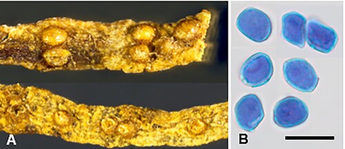 Figure 5. Puccinia abrotanellae on Abrotanella pusilla: A, Aecia. B, Aeciospores (in aniline blue). Scale bar = 20 μm.