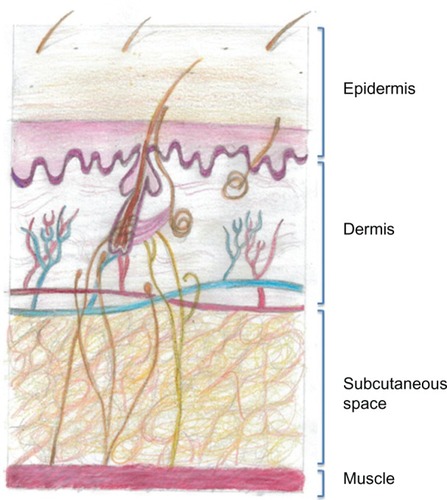 Figure 1 Drawing of the structure of the anatomy of human skin. The subcutaneous space contains cells and extracellular matrix, within which are such structural components such as collagen and elastin fibers that support blood and lymphatic vessels. All of the cells and vessels and the structural–scaffold proteins collagen and elastin are embedded in a gel-like substance made up of glycosaminoglycans and proteoglycans. When a subcutaneous injection is given, small molecules are absorbed through the capillary endothelium; however larger molecules, such as antibodies, are excluded from capillaries and enter through the larger pores of the fenestrated lymphatic endothelium.