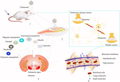 Figure 1. The strategy and effect of low intensity focused ultrasound in the treatment of PD. 1. LIFU combined with MBs opens the BBB. 2. LIFU acts on specific parts of the mice brain, such as the motor cortex, substantia nigra, striatum and other specific sites. 3. Microvesicles or nanoparticles deliver relevant genes or therapeutic drugs such as polymeric nanoparticle, dendrimer, nanogel, magnetic nanoparticle, viral-based nanoparticle, micelle and liposome. 4. Therapeutic substances typically pass through an open BBB in two ways: the paracellular route and the transcellular route.