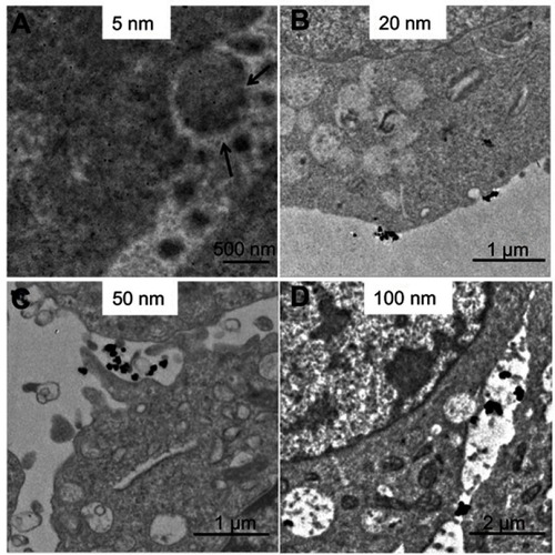 Figure 3 Interaction of AgNPs with plasma membrane after 0.5 hours exposure by TEM analysis. (A–D) The representative TEM images of 5 nm, 20 nm, 50 nm, and 100 nm AgNPs. Black arrows, vesicle-like structures outside the cell membrane.Abbreviations: AgNPs, silver nanoparticles; TEM, transmission electron microscopy.
