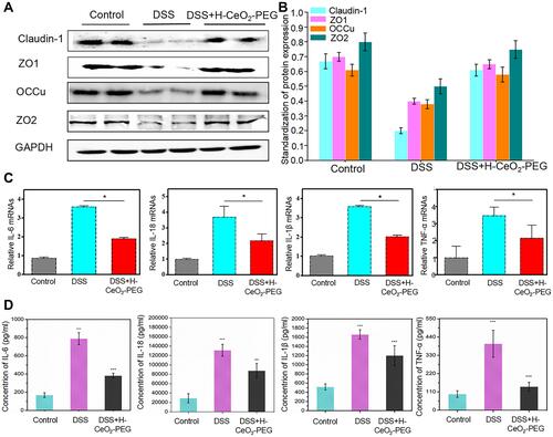 Figure 6 Evaluation of therapeutic effects of H-CeO2-PEG. (A and B) Western blotting analysis and quantification of claudin-1, ZO1, Occu and ZO2 protein expression in colitis tissue from each group. (C) qPCR analysis of IL-6, TNF-α, IL-1β, and IL-18 mRNA expression in colitis tissue from each group. (D) Elisa quantification of IL-6, TNF-α, IL-1β, and IL-18 mRNA expression in colitis tissue from each group. *P< 0.05; **P< 0.01; **P< 0.001. A P value less than 0.05 was defined as statistically significance.