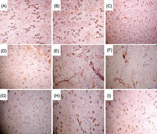 Figure 9. Renal interstitial microvessel at different times in each group (immunohistochemical staining, CD34, ×100). (A–C) Renal interstitial microvessel of sham group at 4, 8, and 12 weeks; peritubular microvascular density was not reduced. (D–F) Renal interstitial microvessel of model group at 4, 8, and 12 weeks; peritubular microvascular density was reduced progressively. (G–I) Renal interstitial microvessel of EPCs-N, pZ-EPCs-N, and pZ-TERT-EPCs-N groups at 12 weeks; all the peritubular microvascular density were reduced, but significantly higher than that of the model group.