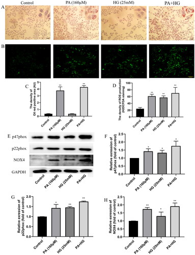 Figure 6. Effects of PA and PA + HG on lipid deposition and oxidative stress in the HMCs. (A) The results of lipid deposition in the HMCs (Oil Red O staining, ×200). (B) The ROS production of HMCs (H2DCFDA, ×200). (C) The mean density of Oil Red O staining in the HMCs. (D) The mean density of ROS production in the HMCs. (E) The bands of p47phox, p22phox, NOX4, and GAPDH (Western blotting). (F) The relative expression of p47phox over control. (G) The relative expression of p22phox over control. (H) The relative expression of NOX4 over control. The data are expressed as the mean ± SD, n = 3, *p< 0.05, **p< 0.01 compared with the control group.