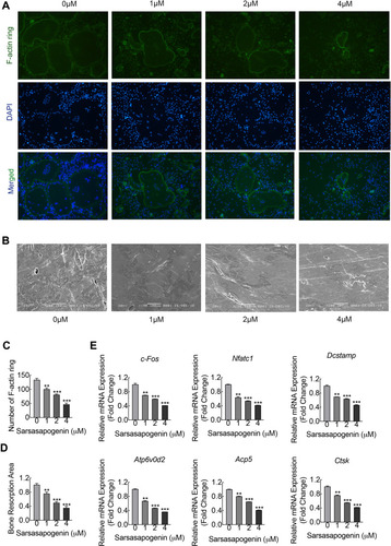 Figure 2 Sarsasapogenin inhibits F-actin ring and bone resorption in vitro. (A) Effect of sarsasapogenin on the fusogenic potential of osteoclast precursor cells. Representative immunofluorescence images of F-actin rings (Acti-stain™ 488 Fluorescent Phalloidin; green) from BMM-derived osteoclasts stimulated with 100 ng/mL RANKL with or without the indicated concentrations of sarsasapogenin. Nuclei were counterstained with DAPI (blue) (magnification = 100×; scale bar = 100 μm). (B) Equal numbers of pre-osteoclasts were seeded onto bone slices and stimulated with M-CSF and RANKL in the presence of different concentrations of sarsasapogenin. After 3 days, bone resorption lacunae were observed by SEM (magnification = 200 ×; scale bar = 100 μm). (C) F-actin rings were quantified using ImageJ (n = 3). (D) The resorption pit area (%) was quantified using ImageJ (n = 3). (E) Dose-dependent mRNA expression profile of osteoclast marker genes. RT-qPCR was conducted using RNA extracted from cells stimulated with 100 ng/mL RANKL with or without the indicated concentrations of sarsasapogenin for 5 days. mRNA levels of c-FOS, NFATc1, DC-STAMP, ATP6V0d2, TRAP, and CTSK were normalized to that of β-actin and then compared to RANKL-only control (0) to obtain the relative fold change (n = 3). Bar graph presents the mean ± SD. **p < 0.01, and ***p < 0.001 versus RANKL-treated only control.