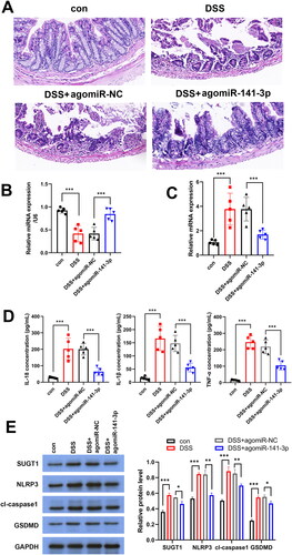 Figure 6. miR-141-3p alleviates DSS-induced ulcerative colitis in mice. A: HE staining was used to detect the protective effect of agomiR-141-3p on DSS-induced mouse intestinal epithelial tissue. B, C: RT-qPCR analysis the expression of miR-141-3p (B) and SUGT1 (C) in vivo. D: ELISA was used to determine the expression of IL-1β, IL-18 and TNF-α in serum of UC mice inject with agomiR-141-3p. *p < 0.05, **p < 0.01, ***p < 0.01.