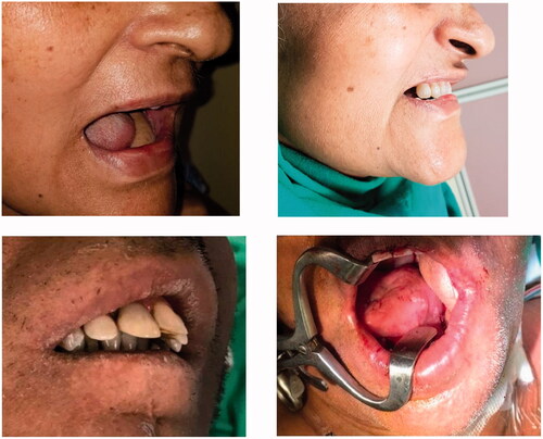 Figure 4. Pre and post-operative results.