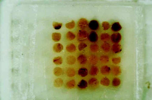 Figure 1.  Picture of gastric cancer tissue microarray section