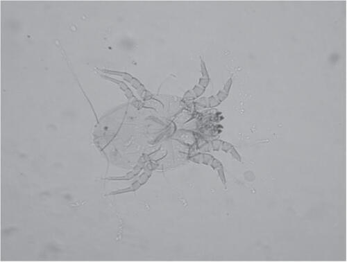 Figure 1 A light micrograph of a house dust mite (Dermatophagoides pteronyssinus).These mites are around 100–300 µm and their secretions contain multiple soluble allergenic proteins. Glasgow University Hunterian Museum Zoology Specimen 127238.