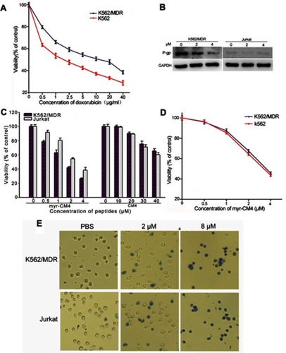 Figure 1 Cytotoxicity of myristoyl-CM4 in leukemia cells. K562/MDR cells were identified using doxorubicin by MTT assay (A) and P-gp expression by Western blotting (B). MTT results in K562/MDR and Jurkat cells after treatment with myristoyl-CM4 or CM4 for 24 hours (C). Cytotoxic comparison of myristoyl-CM4 in K562/MDR and K562 was conducted by MTT assay for 24 hours (D). The data represents the mean of four independent experiments (n=4±SEM). (E) Trypan Blue exclusion was observed by microscopy.