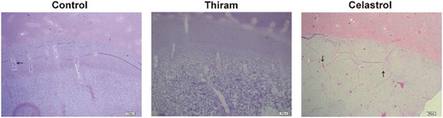 Figure 2. Samples were collected, then tibial growth plates were stained with haematoxylin and eosin. Growth plate of TD-affected chicks was less vascularized and the columnar arrangement of the chondrocytes was lost. After celastrol administration, the columnar organization in growth plate was restored with developing blood vessels (Arrows (→) represent the BV) in the hypertrophic area (Bar = 200 µm).