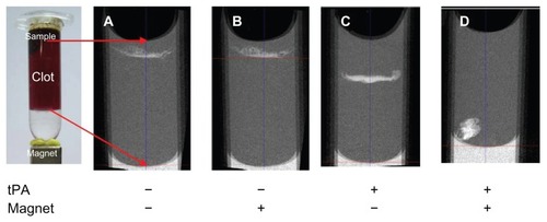 Figure 12 Microcomputed tomography imaging of the penetration of silica-coated magnetic nanoparticles into blood clot with or without immobilized tissue plasminogen activator (tPA) and with or without a magnet at the clot bottom for magnetic guidance.Note: The red arrows indicate imaging boundaries.