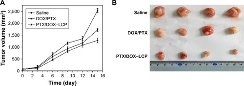 Figure 8 (A) The tumor volume curves of the saline, DOX/PTX, and PTX/DOX–LCP groups. (B) The images of tumor tissues excised from the tumor-bearing nude mice of the saline, DOX/PTX, and PTX/DOX–LCP groups.Abbreviations: LCP, lipid-coated hollow calcium phosphate; DOX, doxorubicin; PTX, paclitaxel.