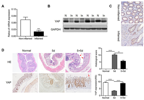 Figure 1 YAP expression was downregulated in human UC lesions and DSS induced colitis of mice. (A) mRNA levels; (B) protein levels and (C) IHC analysis of YAP expression in inflamed and non-inflamed colonic tissues of human UC. (D). HE staining and YAP expressions in colonic mucosa of DSS induced mice with successive 5 days DSS induction and 5 days after DSS removal (n=4 each), the experiments were carried out in three independent replications. The bar graph represented histological scores and IHC statistical analysis of YAP among different groups. N represented with non-inflamed; In represented with inflamed. Scale bars =50μm. Data were presented as mean ± SEM, **p <0.01, ***P< 0.001, ****P< 0.0001.