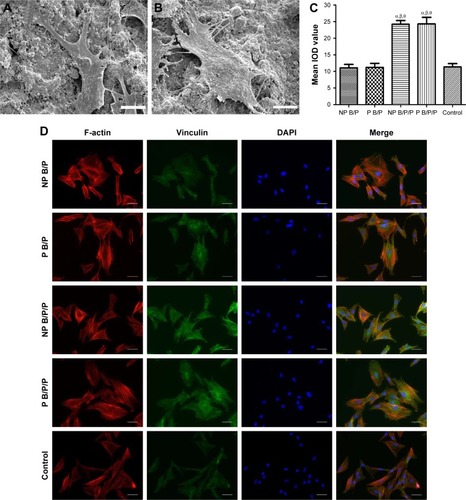 Figure 4 Assessment of BMSC adhesion to the printed scaffolds.Notes: Scanning electron microscopy analysis of the adhesion status of BMSCs on P B/P scaffolds (A) and P B/P/P scaffolds (B) at 24 h after seeding; scale bars: 10 μm. (C) Quantitative analysis of the integral optical density value for vinculin fluorescence for BMSCs seeded on NP B/P scaffolds, P B/P scaffolds, NP B/P/P scaffolds, and P B/P/P scaffolds. Results are mean ± standard deviation (χ ± SD), n=3; αP<0.05 vs NP B/P scaffolds; βP<0.05 vs P B/P scaffolds; θP<0.05 vs cell culture plates. (D) Representative images of immunofluorescence staining for F-actin (red), vinculin (green), and nuclei (4′,6-diamidino-2-phenylindole, blue) in BMSCs seeded on scaffolds or cell culture plates (control) at 24 h after seeding; scale bars: 50 μm.Abbreviations: BMSCs, bone marrow-derived mesenchymal stem cells; IOD, integral optical density; NP B/P, nonprinted biphasic calcium phosphate/polyvinyl alcohol; NP B/P/P, nonprinted biphasic calcium phosphate/polyvinyl alcohol/platelet-rich fibrin; P B/P, printed biphasic calcium phosphate/polyvinyl alcohol; P B/P/P, printed biphasic calcium phosphate/polyvinyl alcohol/platelet-rich fibrin.