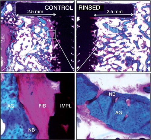 Figure 4. Histology: representative histological sections from the two groups. The sections shown are from the two implants inserted in the same animal. Porous-coated Ti implants are surrounded by a 2.5-mm concentric defect. The sections are cut parallel to the long axis of the implant. Left-hand panels (control): fibrous (FIB) tissue at the implant (IMPL) surface. Right-hand panels (rinsing): new bone (NB) on graft (AG) remnants.