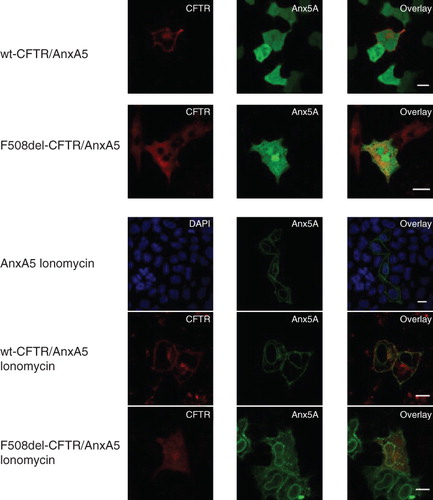 Figure 5. CFTR and AnxA5 do not co-localize in vivo. (A) Confocal images of HeLa cells transiently co-transfected with GFP-AnxA5 and either mCherry-flag-wt-CFTR (upper row) or mCherry-flag-F508del-CFTR (lower row). Columns from left to right: mCherry-CFTR; GFP-AnxA5; overlay of mCherry-CFTR and GFP-AnxA5. (B) Confocal images as in A but after treatment with 10 μM ionomycin for 5 min: HeLa cells transiently co-transfected with GFP-AnxA5 alone (upper row); GFP-AnxA5 and mCherry-flag-wt-CFTR (middle row); or GFP-AnxA5 and mCherry-flag-F508del-CFTR (lower row). Columns from left to right: DAPI nuclear staining (in AnxA5 alone cells) or mCherry-CFTR; GFP-AnxA5; overlay of the two previous columns. Scale bar: 10 μm. Cells were observed using a LSM710 Zeiss confocal microscope. Images are representative of at least n = 50 cells from n = 5 independent transfections.