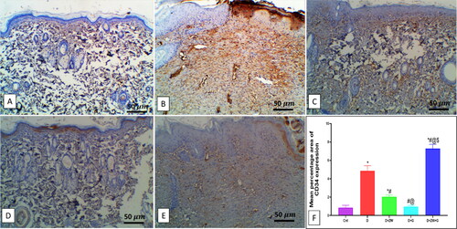 Figure 10. Representative photomicrograph of CD34 immunoexpression in skin section of different treatment groups. A: the control group shows no expression of CD34. B: the diabetic group shows a moderate expression of CD34 in dermal tissue, and the Insets show moderate cytoplasmic and nuclear expression in invading inflammatory and capillary endothelial cells. C: the diabetic + ZW group shows minimal focal expression in the cytoplasm of superficial epidermal cells. D: the diabetic + dapagliflozin group shows a mild expression of CD34 with little epidermal expression and mild expression in subepidermal cellular infiltrate and vascular endothelial cells. E: the diabetic + ZW + dapagliflozin group shows high expression in epidermal cells, dermal endothelial cells, inset, moderate expression in endothelial cells with few expressions in inflammatory cells. F: Histogram showing the percentage of skin that was immunostained with CD34. * vs. Control group; # vs. Diabetic group; @ vs. Diabetic + ZW group, and $ vs. Diabetic + dapagliflozin group. Image magnification = 400X, bar = 50 µm.