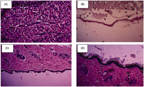 Figure 6. (A) Histological interpretation of control, (B) cefazolin, (C) gelatin nanofiber and (D) cefazolin-loaded gelatin nanofiber.
