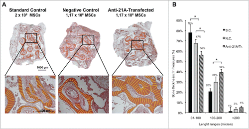 Figure 4. An increased bone mineralized area thickness is detected in implants from Anti-21A RNAs-transfected MSCs. (A) Reconstituted Hematoxilin/Eosin-stained skelite sections of different implant conditions and their respective magnifications. (B) Thickness distribution of mineralized tissue bone matrix deposition area. (SC: standard control group; NC: negative control group; Anti-21A/Tr: Anti-21A RNAs-transfected group).