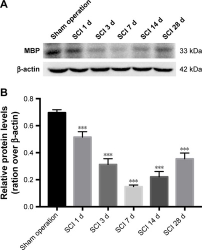 Figure 6 The protein expression of MBP was detected using Western blotting analyses.