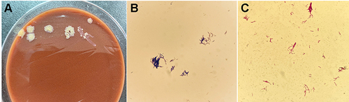 Figure 3 (A) Original culture result of Gordonia crocea (chocolate plate); (B) Gordonia crocea Gram staining result; (C) Gordonia crocea weakly acid-fast result.