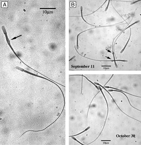 Figure 2 C. mexicanus spermatozoa. With cytoplasmic droplet (A, arrow). (B) Sperm cells exhibiting a high percentage with cytoplasmic droplet in the cauda epididymis (∼20%) in September that steadily decrease, reaching almost nil at the end of October.