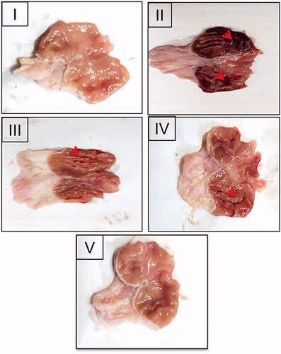 Figure 6. Gross appearance of the freshly excised stomachs of: (I) the normal control, (II) the positive control, the rats pretreated with (III) NIZ (30 mg/kg), an equivalent dose of (IV) the uncrosslinked 8:2 CS:PEO NFs and (V) the crosslinked 8:2 CS:PEO NFs. Red arrows point to the glandular mucosal congestion and ulceration.