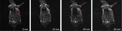 Figure S2 The MRI maps of PDG taken at different time points after injection in the H22 tumor-bearing mice.Note: The red circles represent the region of interest to calculate the MRI intensity.Abbreviations: Gd, gadolinium; MRI, magnetic resonance imaging; PDG, poly (l-lysine)-diethylene triamine pentacetate acid-Gd.